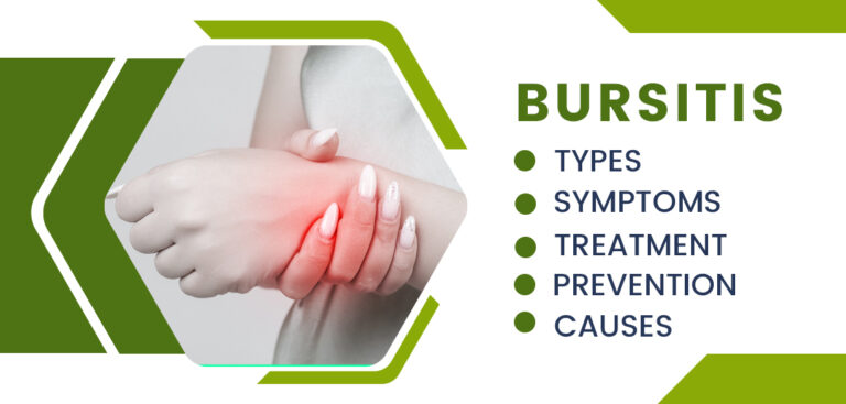 Bursitis: Symptoms, Causes, Treatment, and Prevention
